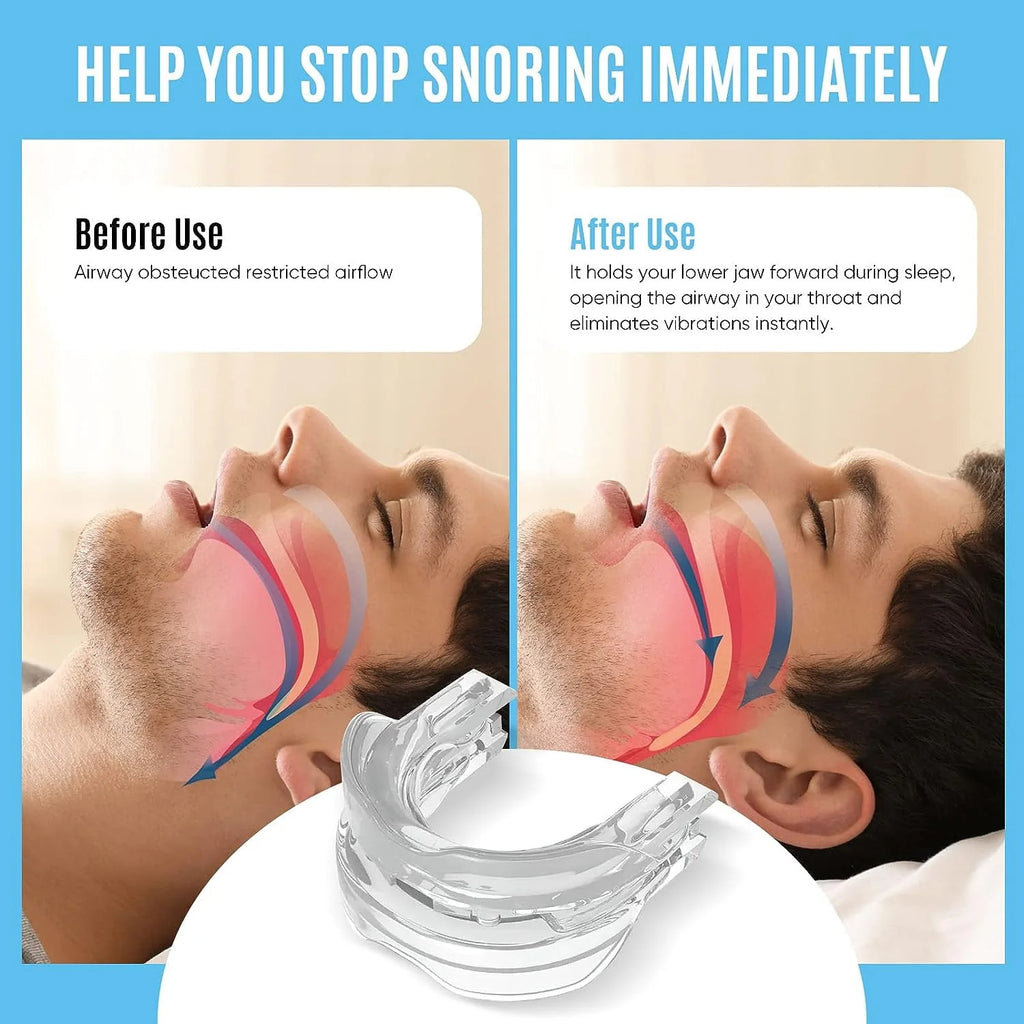 Anti Snoring Adjustable Mouthpiece G3246