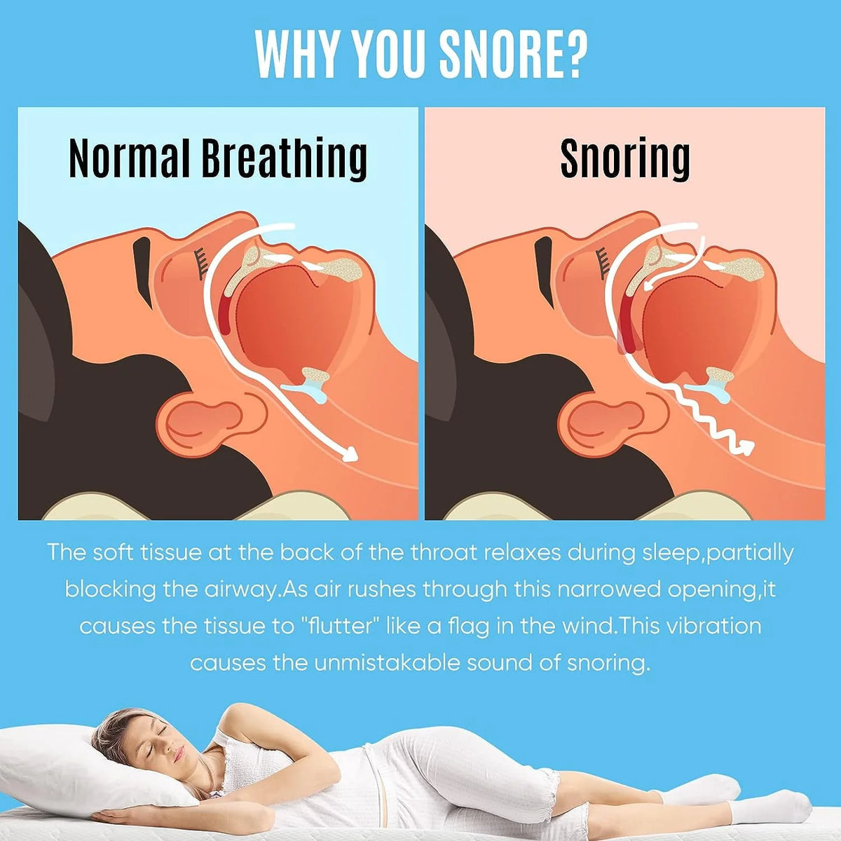 Anti Snoring Adjustable Mouthpiece G3246