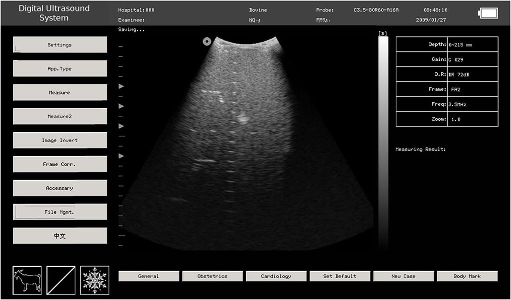 Portable Veterinary Ultrasound Machine with Convex and Linear Probe X49065