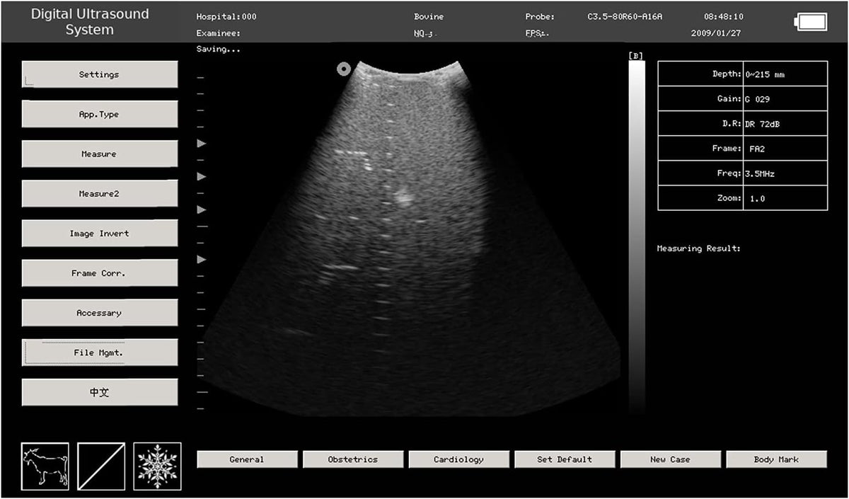 Portable Veterinary Ultrasound Machine with Convex and Linear Probe X49065