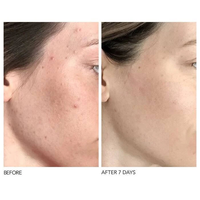 Daily Peel 60 Treatments L242